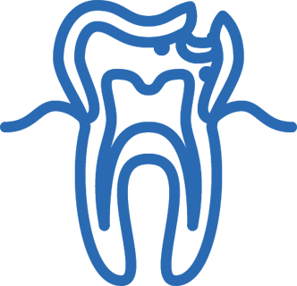 Endodontologie (Wurzelkanalbehandlung)